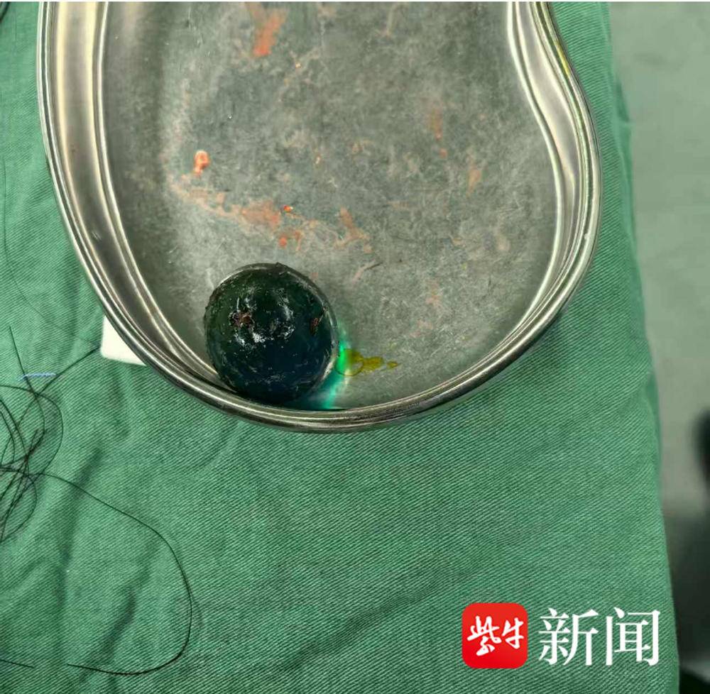 又是水宝宝，误食后膨胀几十倍的“水宝宝”险撑破一岁娃肠子