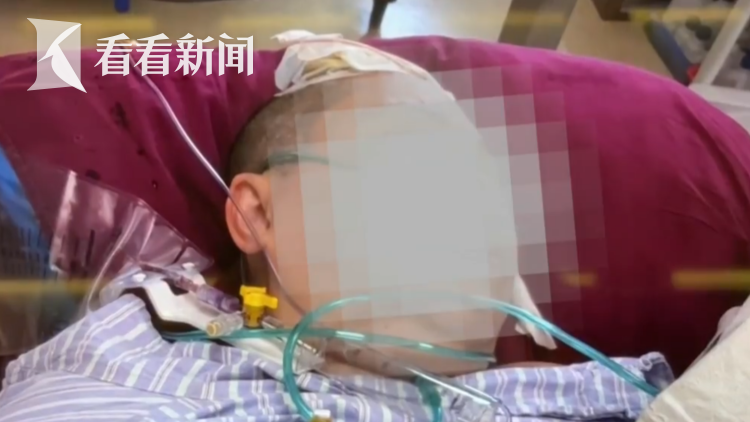 中年女子孑然一身突发脑出血，谁来做监护人？