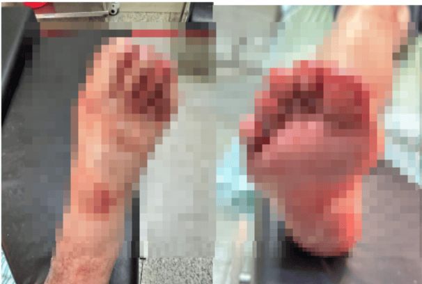 突然炸了！9岁女孩在卫生间痛哭，妈妈冲进一看：头皮发麻……