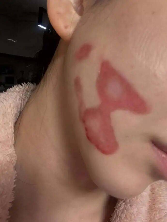 韩国女歌手自曝医美后毁容，准备起诉；曾自杀获救