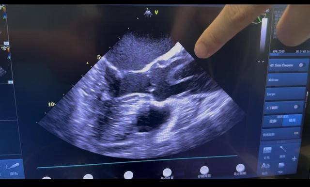 新春走基层 大年初一生命竞速，青岛空地联动挽救主动脉夹层患者